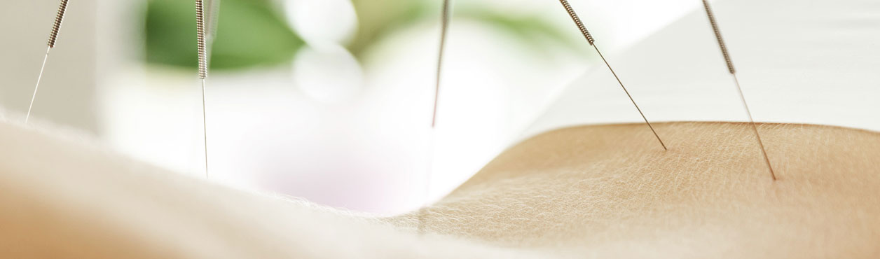 Traditionelle chinesische Akupunktur in Berlin